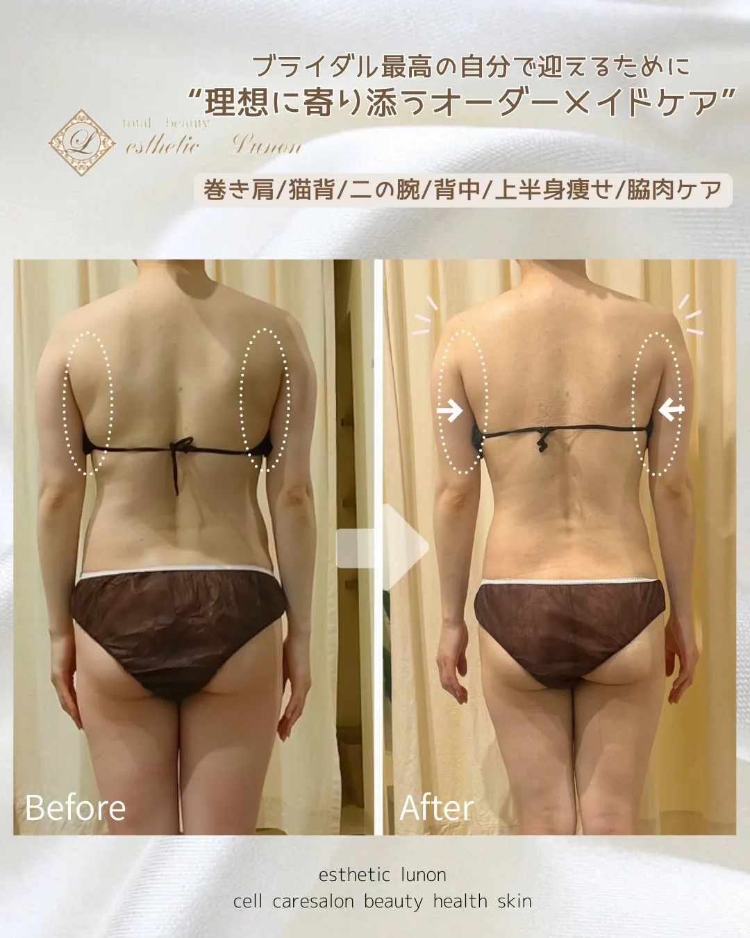 ウェディングフォトに向けて